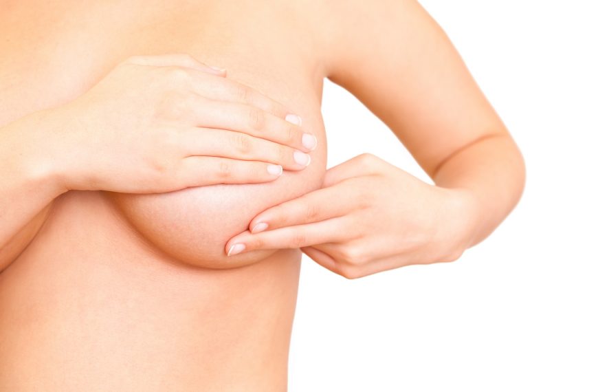 Factores de riesgo del C&aacute;ncer de Mama.