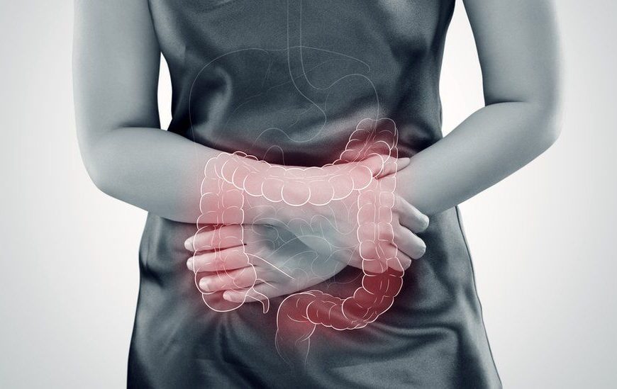 El C&aacute;ncer Colorrectal